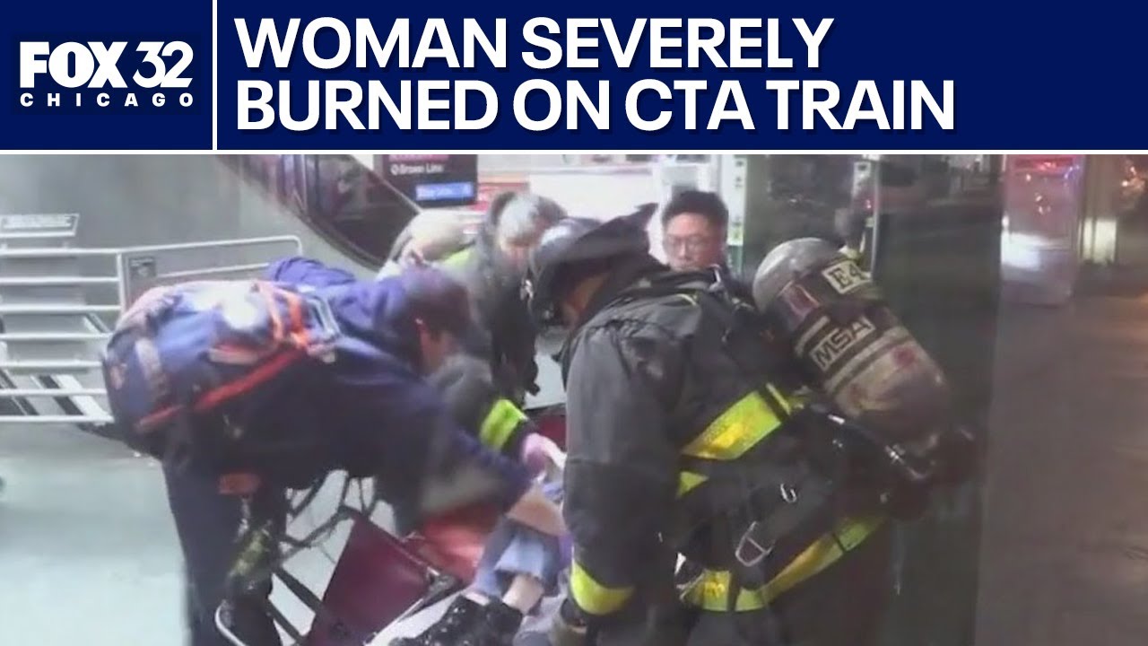 Chicago Woman With 60% Burns Released After Subway Attack